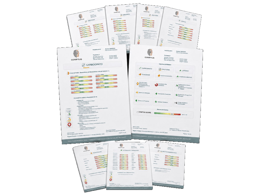 Metabolômica